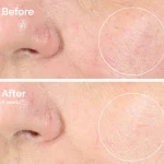 سرم اوردینری مدل The Ordinary Alpha Arbutin 2% Ha