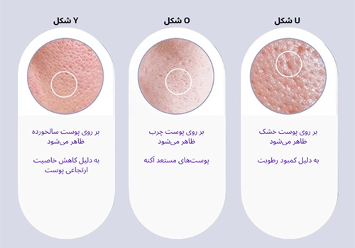 منافذ باز پوست