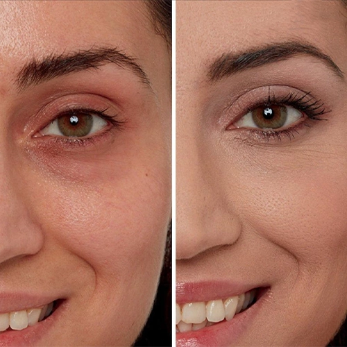 بهترین کرم دور چشم برای تیرگی زیر چشم 1 بهترین کرم دور چشم برای تیرگی زیر چشم