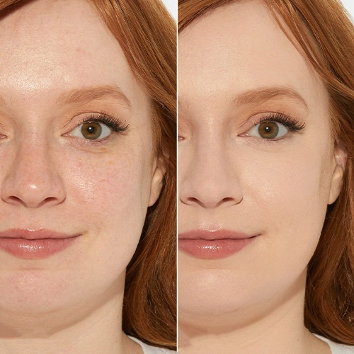 لوازم آرایشی کرمان: مقایسه کانسیلر رولوشن و فرین کازمتیک 4 لوازم آرایشی کرمان: مقایسه کانسیلر رولوشن و فرین کازمتیک